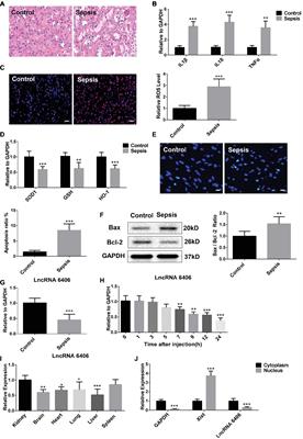 Frontiers Long Noncoding Rna Tcons Attenuates